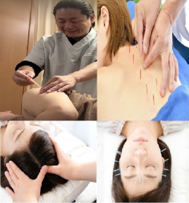 メニュー:鍼灸治療90分+美容鍼 イメージ